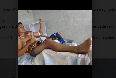 Imagen de la noticia: Bomberos INEA Maracaibo: Se requiere con urgencia suero antiofidico