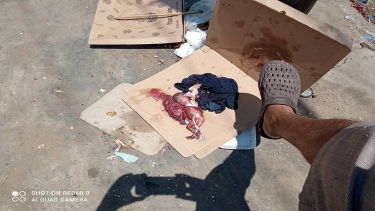 Imagen de la noticia: Municipio Maracaibo: Dejan feto aún en su saco amniótico tirado en una caja de pizza (imágenes fuertes)