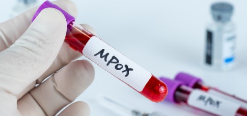 Imagen de la noticia: OMS sustituye nombre de viruela del mono por mpox