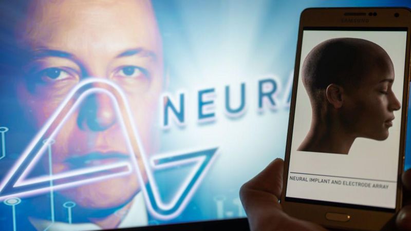 Imagen de la noticia: Elon Musk anuncia el primer implante de un chip en el cerebro de un humano